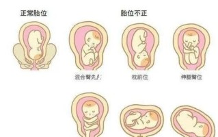 孕妇肚子歪向一边正常吗_孕妇肚子歪是什么原因