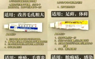 孕妇能用的皮肤软膏有哪些_孕妇湿疹用什么药膏安全