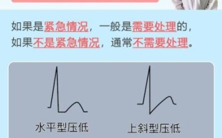 孕妇st段改变严重吗_st段压低对胎儿有影响吗