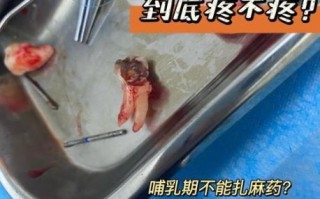 孕妇可以拔牙齿吗_孕期拔牙安全吗