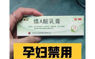 马应龙孕妇能用吗_孕妇痔疮膏安全吗