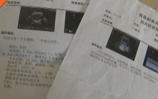 孕妇b超什么时候做_孕妇b超做几次