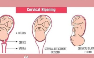 世界上最小的孕妇_她如何顺利分娩