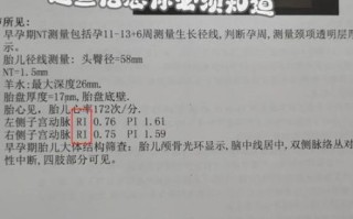 孕妇RI正常值是多少_孕妇RI偏高怎么办