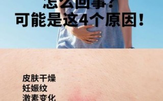 孕妇身上起红疙瘩很痒怎么办_孕期皮肤瘙痒怎么缓解