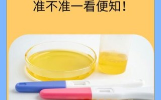 孕妇尿液有什么用_孕妇尿液检测能查什么