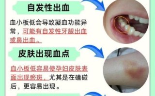 孕妇血小板低能顺产吗_血小板低顺产风险