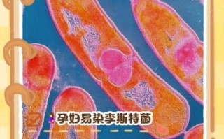 孕妇感染李斯特菌的症状_如何避免李斯特菌感染