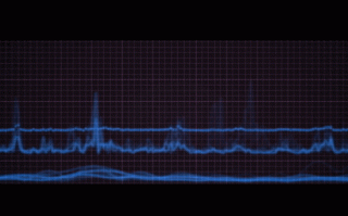 孕妇可以做动态心电图吗_对胎儿有没有影响