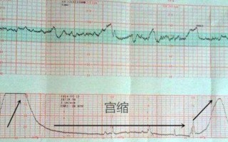 孕妇心率120是缺氧吗_孕妇心率120正常吗