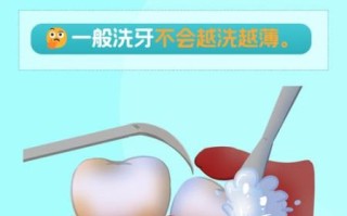 孕妇可以洗牙齿吗_孕期洗牙安全吗