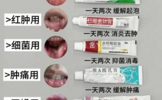 孕妇口腔溃疡能用什么药_孕期口腔溃疡安全用药指南