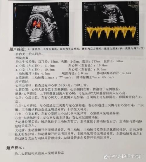孕妇心脏彩超几周做最合适_心脏彩超最佳孕周-第3张图片-星辰妙记