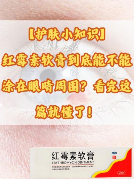 孕妇能用红霉素眼膏吗_孕期红霉素眼膏安全吗-第1张图片-星辰妙记 孕妇能用红霉素眼膏吗_孕期红霉素眼膏安全吗-第1张图片-星辰妙记