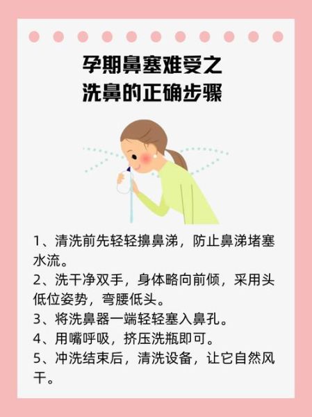 孕妇鼻塞怎么缓解_孕期鼻塞安全方法-第3张图片-星辰妙记 孕妇鼻塞怎么缓解_孕期鼻塞安全方法-第3张图片-星辰妙记
