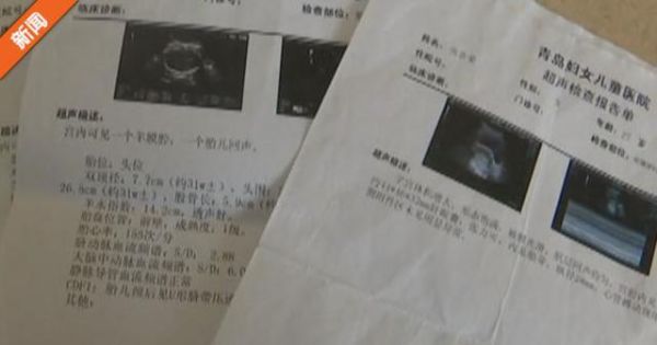 为什么说有钱难买孕妇B_孕妇B超预约难怎么办-第2张图片-星辰妙记