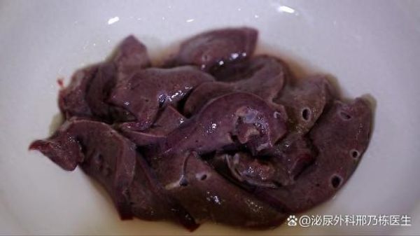 孕妇能吃猪肝吗_孕妇吃猪肝对胎儿好吗-第2张图片-星辰妙记