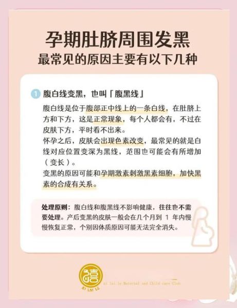 孕妇肚脐眼黑是什么原因_孕妇肚脐发黑怎么改善-第2张图片-星辰妙记 孕妇肚脐眼黑是什么原因_孕妇肚脐发黑怎么改善-第2张图片-星辰妙记
