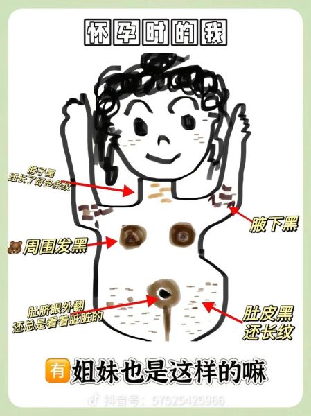孕妇肚脐眼黑是什么原因_孕妇肚脐发黑怎么改善-第3张图片-星辰妙记 孕妇肚脐眼黑是什么原因_孕妇肚脐发黑怎么改善-第3张图片-星辰妙记