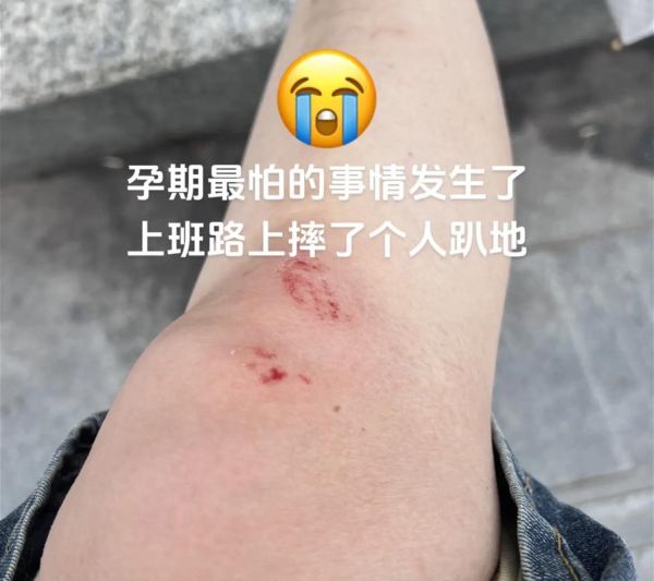 孕妇梦见自己摔倒没事_孕妇梦见摔倒预示什么-第1张图片-星辰妙记 孕妇梦见自己摔倒没事_孕妇梦见摔倒预示什么-第1张图片-星辰妙记