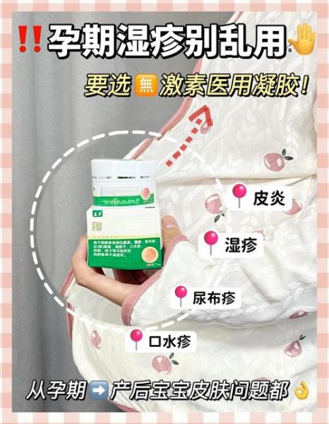 孕妇能用除湿止痒软膏吗_对胎儿有影响吗-第1张图片-星辰妙记