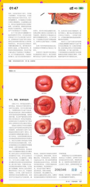 孕妇内检是怎么检查_内检会不会很疼-第2张图片-星辰妙记 孕妇内检是怎么检查_内检会不会很疼-第2张图片-星辰妙记