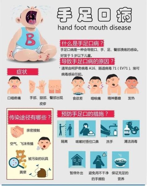 手足口病孕妇会传染给胎儿吗_孕期感染怎么办-第3张图片-星辰妙记