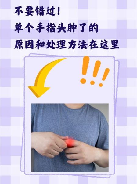 孕妇手肿是什么原因_孕晚期手指肿胀怎么缓解-第1张图片-星辰妙记 孕妇手肿是什么原因_孕晚期手指肿胀怎么缓解-第1张图片-星辰妙记