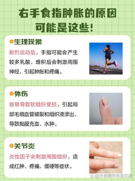 孕妇手肿是什么原因_孕晚期手指肿胀怎么缓解-第2张图片-星辰妙记 孕妇手肿是什么原因_孕晚期手指肿胀怎么缓解-第2张图片-星辰妙记