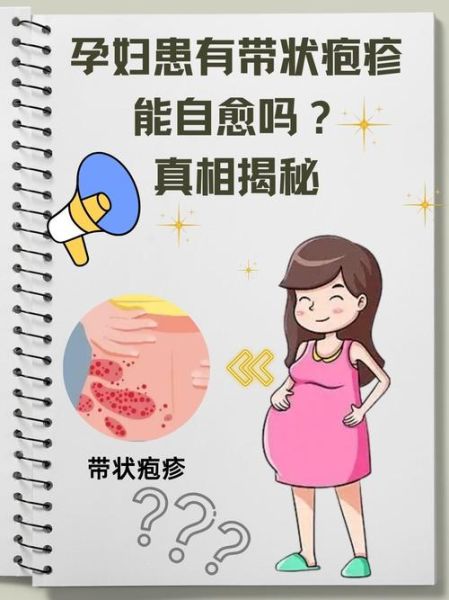 孕妇带状疱疹图片_对胎儿有影响吗-第1张图片-星辰妙记