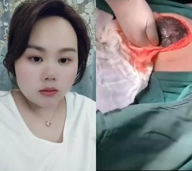 孕妇难产怎么办_难产有哪些症状-第2张图片-星辰妙记