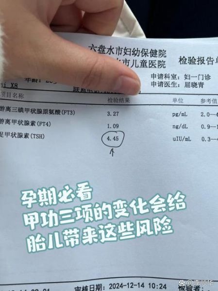 孕妇甲状腺功能异常对胎儿有什么影响_孕期甲状腺检查怎么做-第2张图片-星辰妙记 孕妇甲状腺功能异常对胎儿有什么影响_孕期甲状腺检查怎么做-第2张图片-星辰妙记