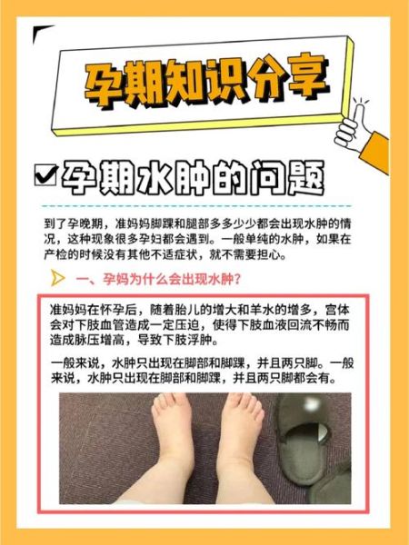 孕妇几个月开始水肿_如何缓解孕期水肿-第2张图片-星辰妙记 孕妇几个月开始水肿_如何缓解孕期水肿-第2张图片-星辰妙记