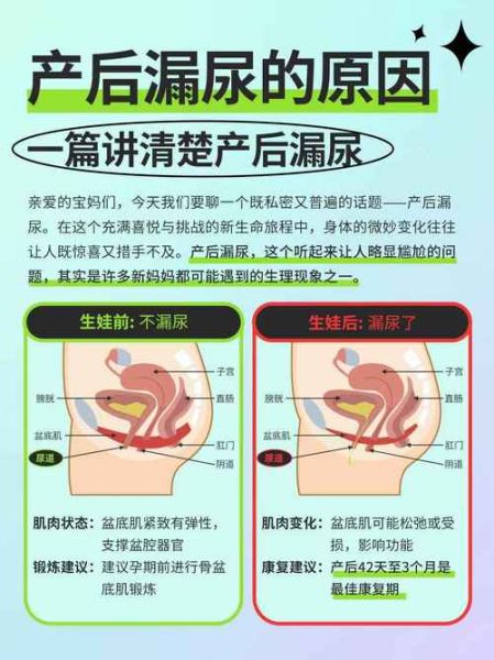 孕妇漏尿一般是几个月_如何缓解-第1张图片-星辰妙记