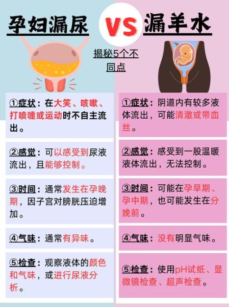 孕妇漏尿一般是几个月_如何缓解-第3张图片-星辰妙记