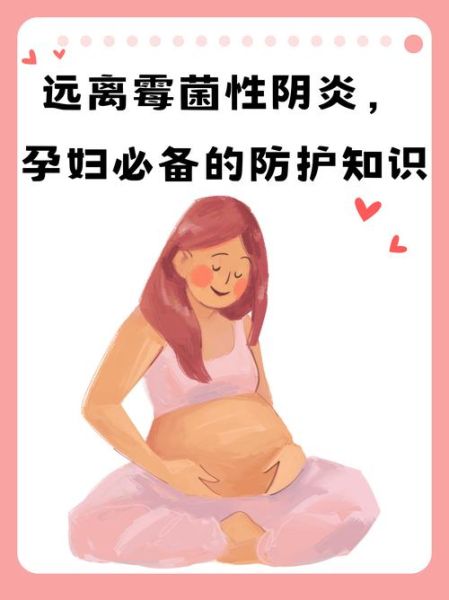 孕妇念珠菌能自愈吗_孕期霉菌感染怎么办-第3张图片-星辰妙记