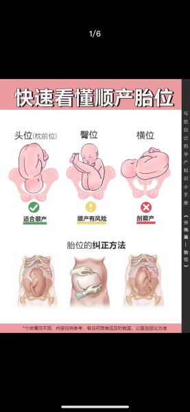 孕妇几个月定胎位_胎位什么时候固定-第1张图片-星辰妙记