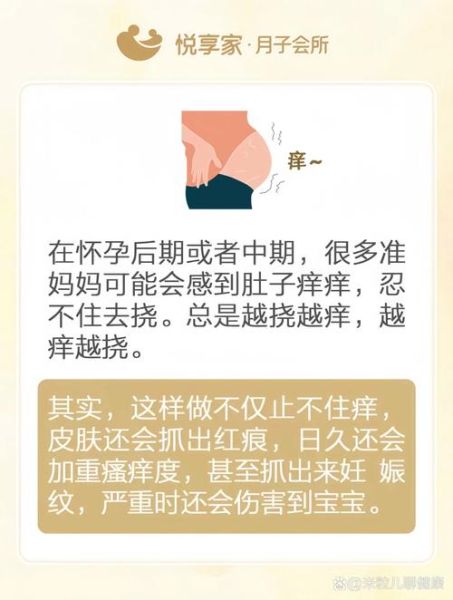 孕妇身上痒是怎么回事_孕妇皮肤瘙痒怎么缓解-第3张图片-星辰妙记