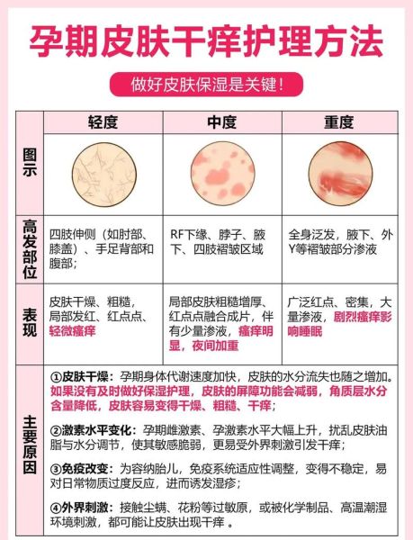 孕妇身上痒是怎么回事_孕妇皮肤瘙痒怎么缓解-第1张图片-星辰妙记