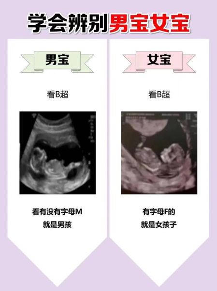 孕妇初乳早怀的是男孩吗_初乳早与胎儿性别关系-第1张图片-星辰妙记