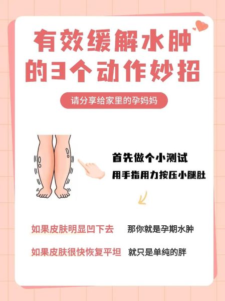 孕妇水肿是什么原因_如何缓解-第1张图片-星辰妙记