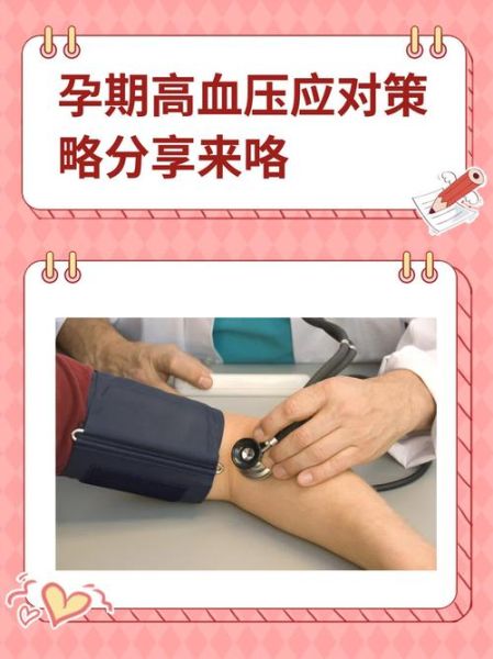 孕妇正常血压是多少_孕期血压偏高怎么办-第1张图片-星辰妙记