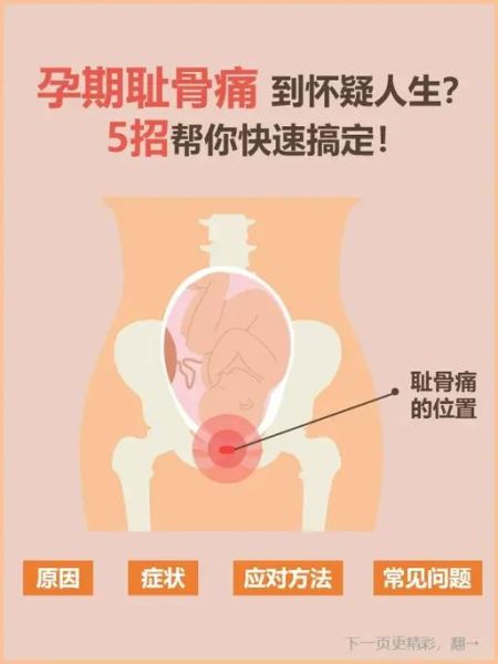 孕妇大腿根疼怎么回事_怎么缓解-第1张图片-星辰妙记 孕妇大腿根疼怎么回事_怎么缓解-第1张图片-星辰妙记