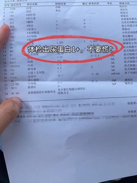 孕妇尿检白细胞高怎么办_孕妇尿蛋白阳性严重吗-第2张图片-星辰妙记