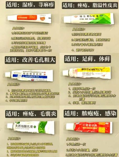 孕妇能用的皮肤软膏有哪些_孕妇湿疹用什么药膏安全-第1张图片-星辰妙记 孕妇能用的皮肤软膏有哪些_孕妇湿疹用什么药膏安全-第1张图片-星辰妙记