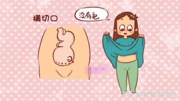 孕妇受到惊吓会影响胎儿吗_孕妇惊吓对胎儿的影响-第3张图片-星辰妙记 孕妇受到惊吓会影响胎儿吗_孕妇惊吓对胎儿的影响-第3张图片-星辰妙记