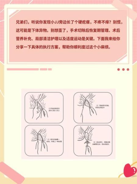 孕妇下面长了个硬疙瘩怎么办_孕妇外阴硬疙瘩原因-第2张图片-星辰妙记