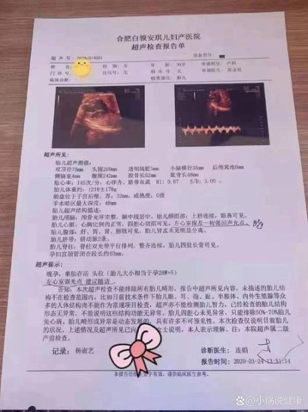 孕妇小排畸检查什么_小排畸几周做最合适-第1张图片-星辰妙记 孕妇小排畸检查什么_小排畸几周做最合适-第1张图片-星辰妙记