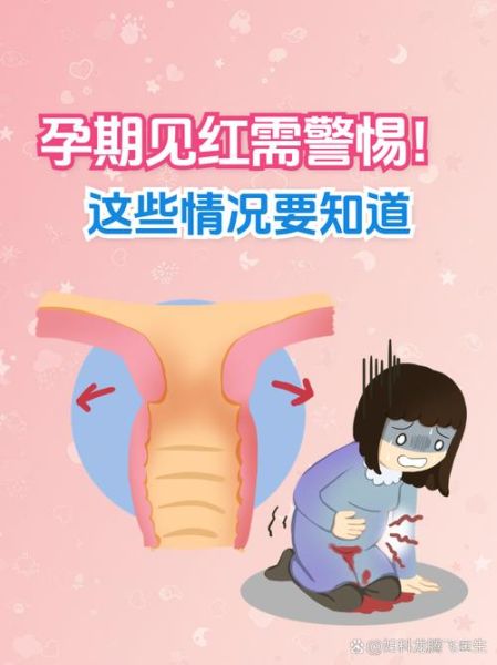 孕妇梦见内裤有血是什么意思_孕晚期见红梦境解析-第3张图片-星辰妙记 孕妇梦见内裤有血是什么意思_孕晚期见红梦境解析-第3张图片-星辰妙记