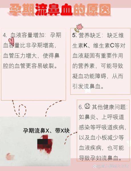 孕妇流鼻血是怎么回事_孕妇流鼻血正常吗-第1张图片-星辰妙记 孕妇流鼻血是怎么回事_孕妇流鼻血正常吗-第1张图片-星辰妙记